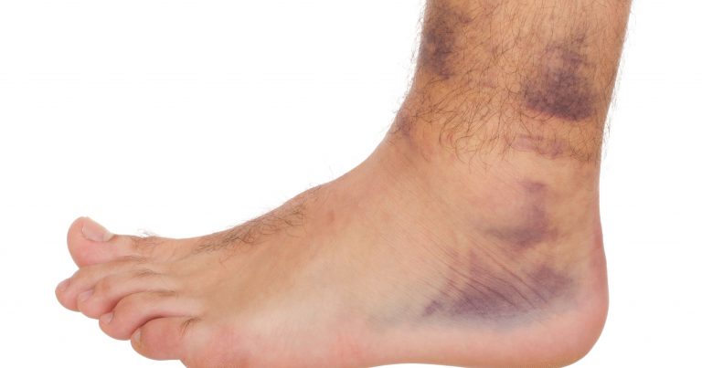 Match report – Aztecs Falcons vs Wolfpack Mohegans